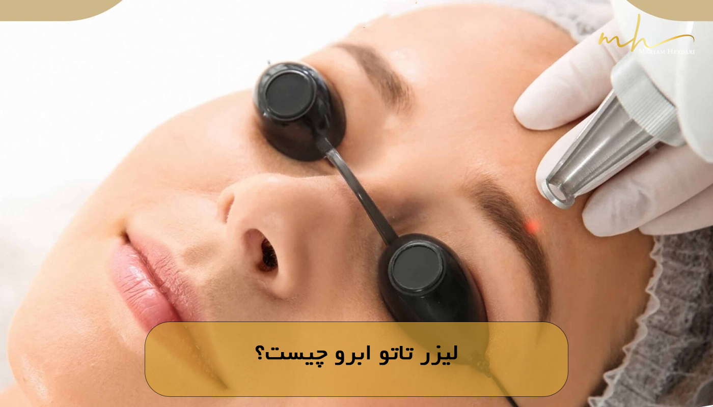لیزر تاتو ابرو چیست؟