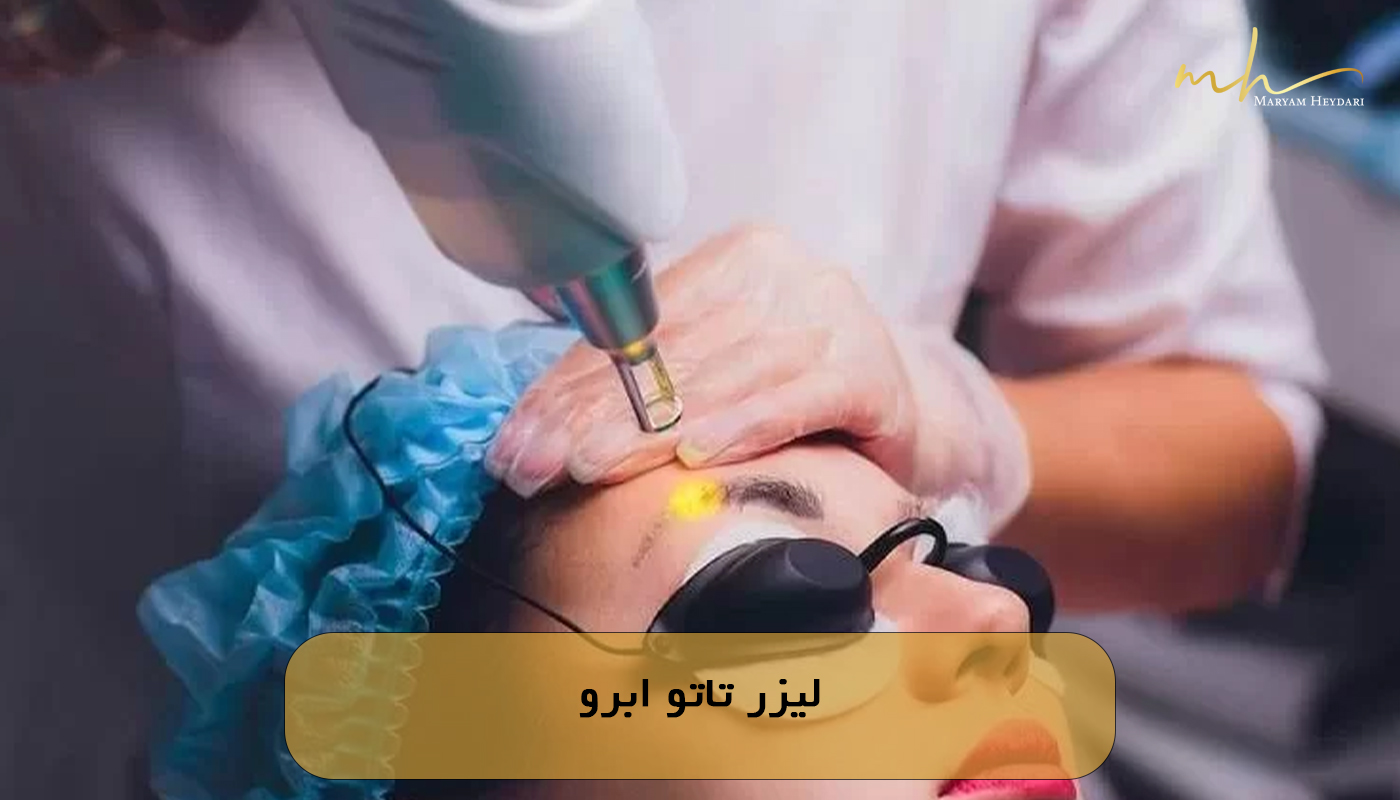 لیزر تاتو ابرو
