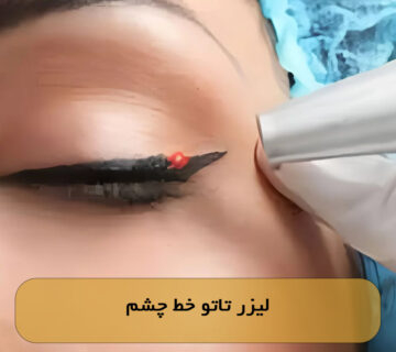 لیزر تاتو خط چشم