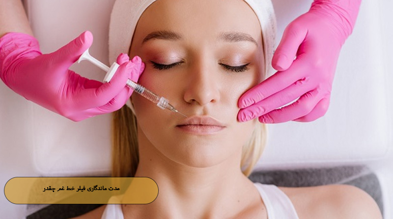 مدت ماندگاری فیلر خط غم چقدر