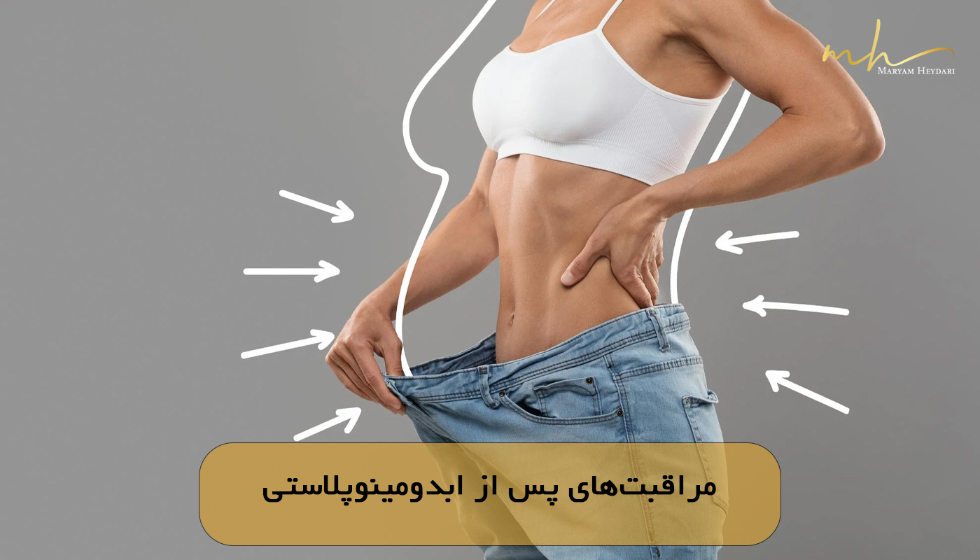 مراقبت‌های پس از ابدومینوپلاستی