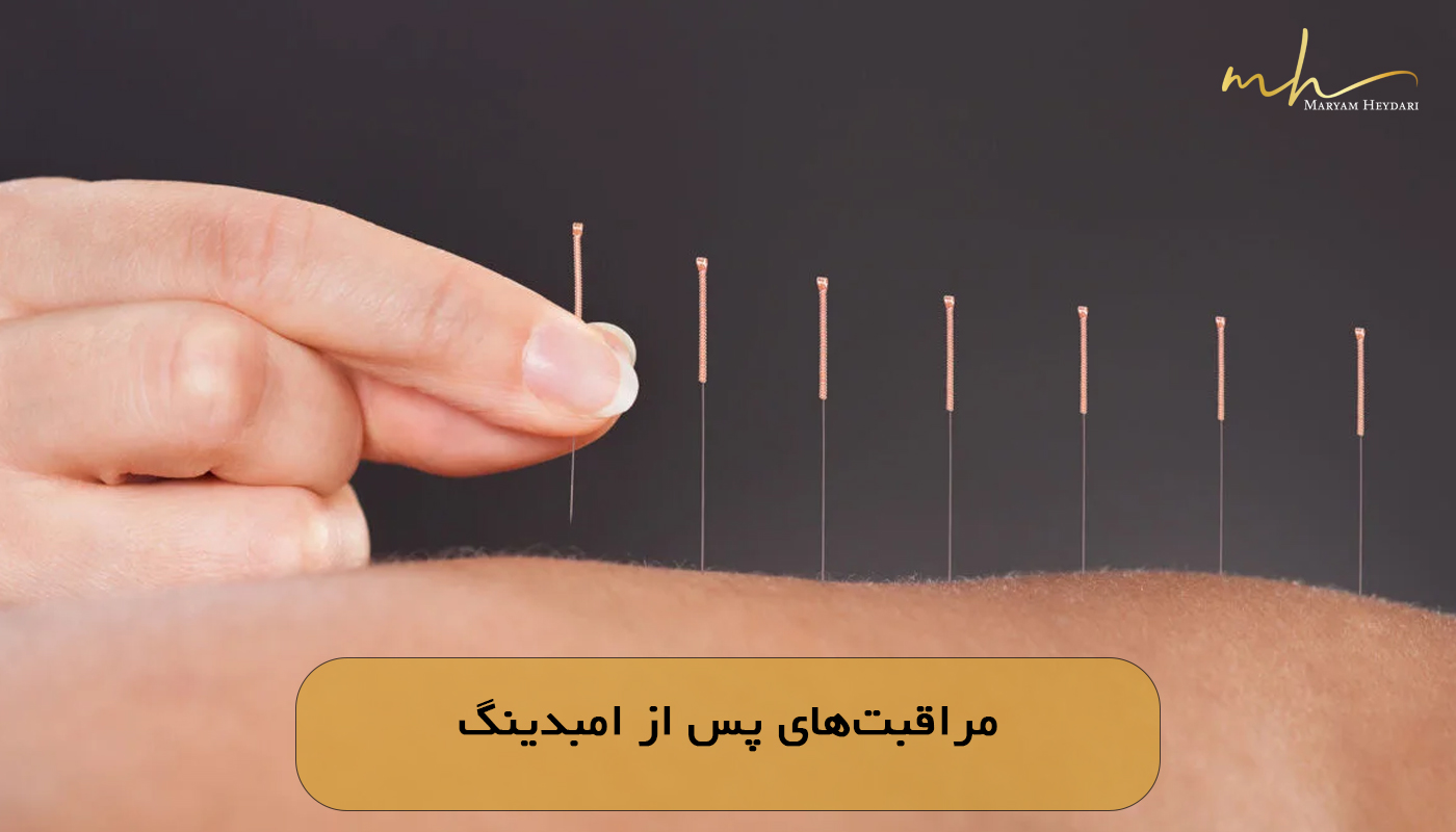 مراقبت‌های پس از امبدینگ