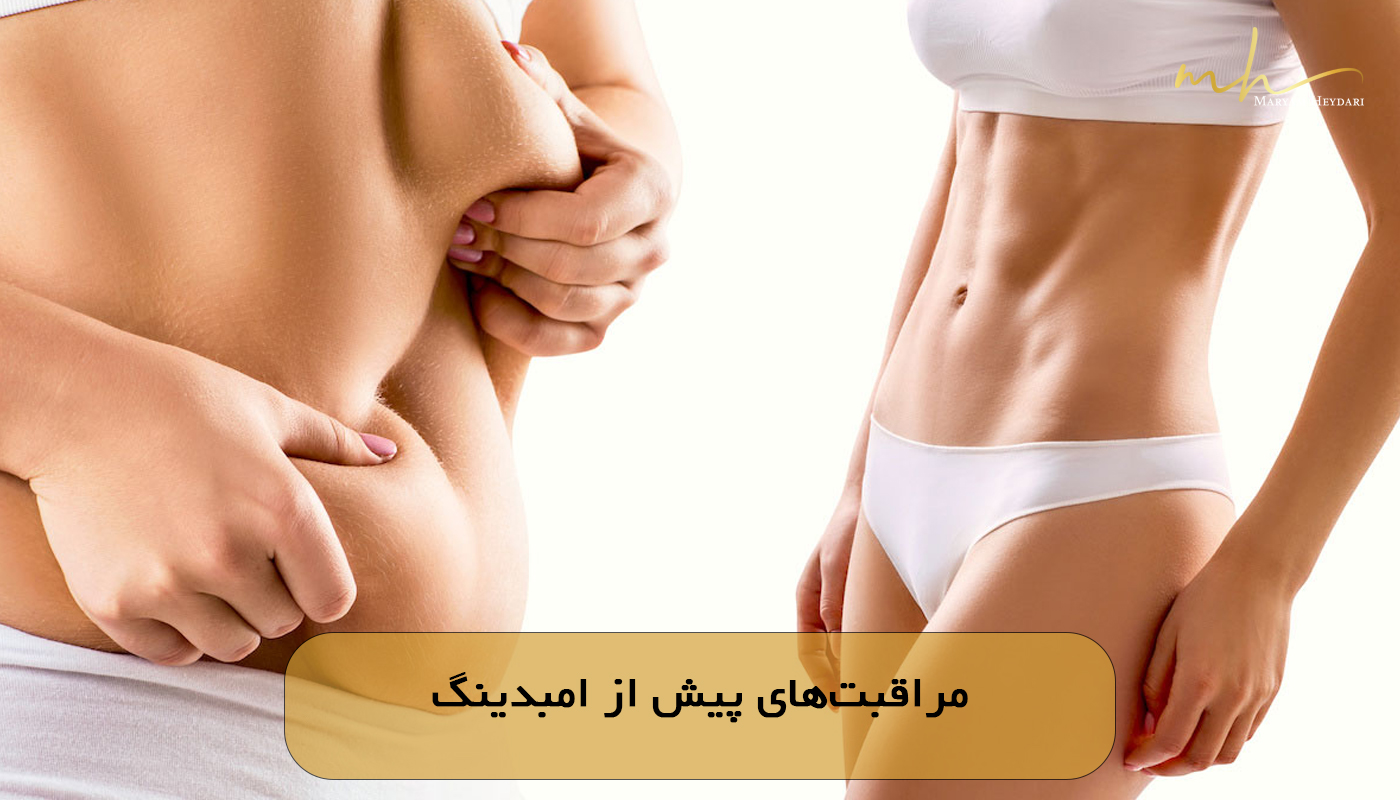 مراقبت‌های پیش از امبدینگ