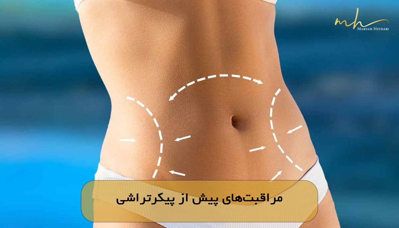 مراقبت‌های پیش از پیکرتراشی