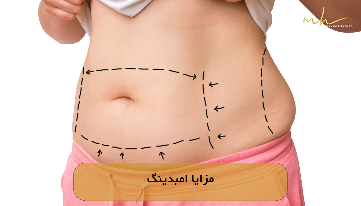 مزایا امبدینگ