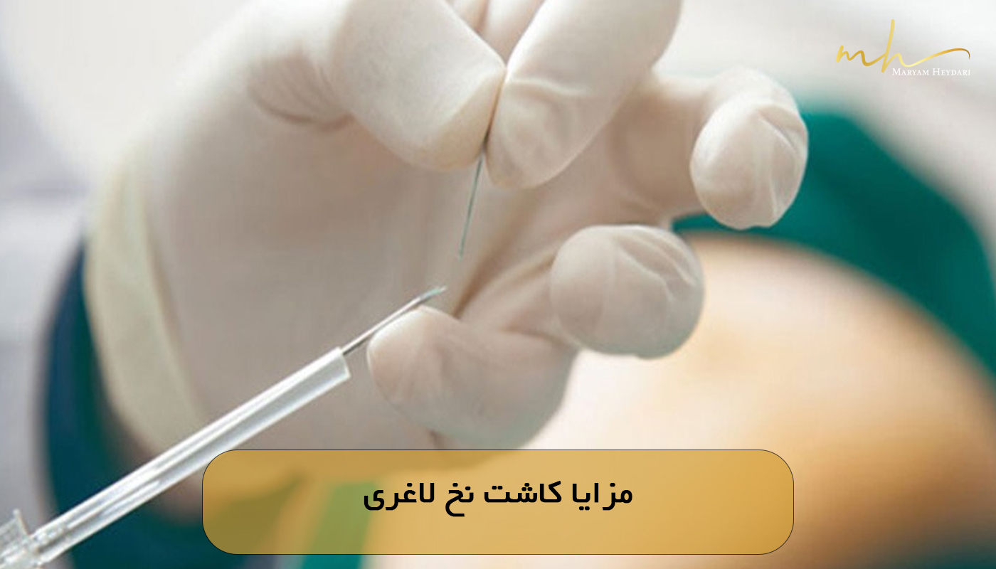 مزایا کاشت نخ لاغری