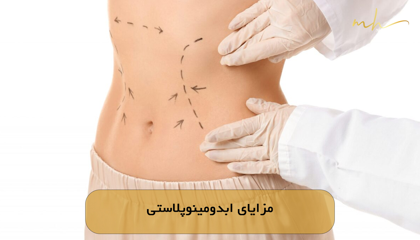 مزایای ابدومینوپلاستی