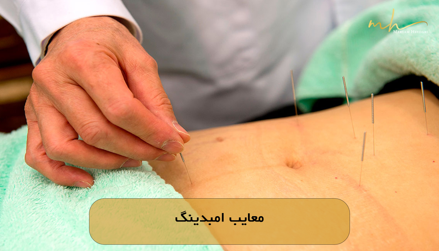 معایب امبدینگ