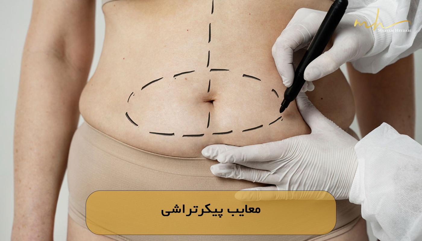 معایب پیکرتراشی