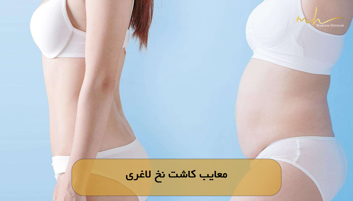 معایب کاشت نخ لاغری