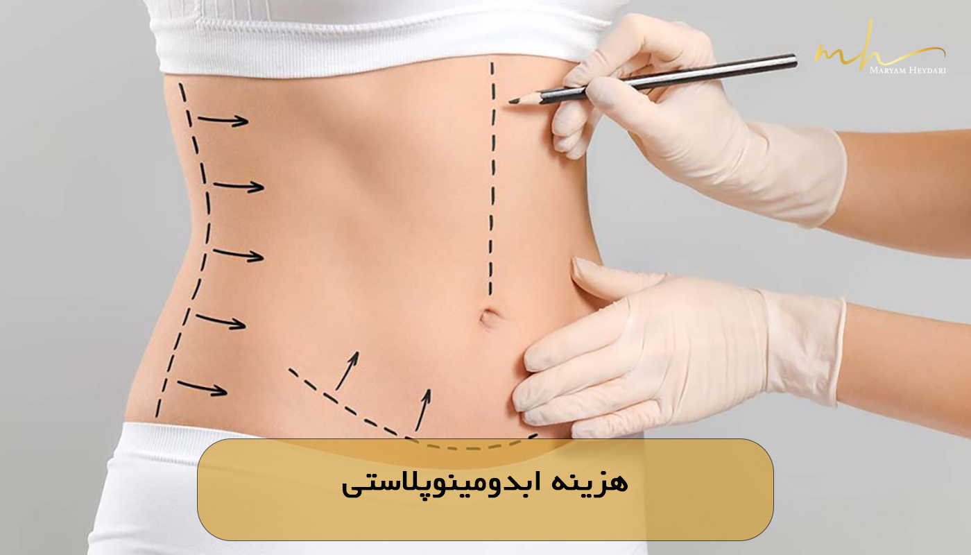 هزینه ابدومینوپلاستی