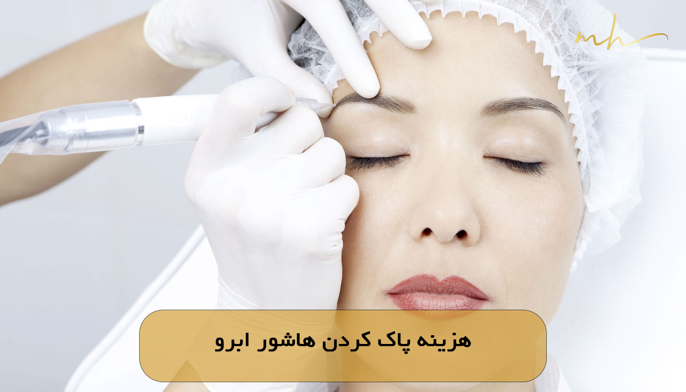هزینه پاک کردن هاشور ابرو