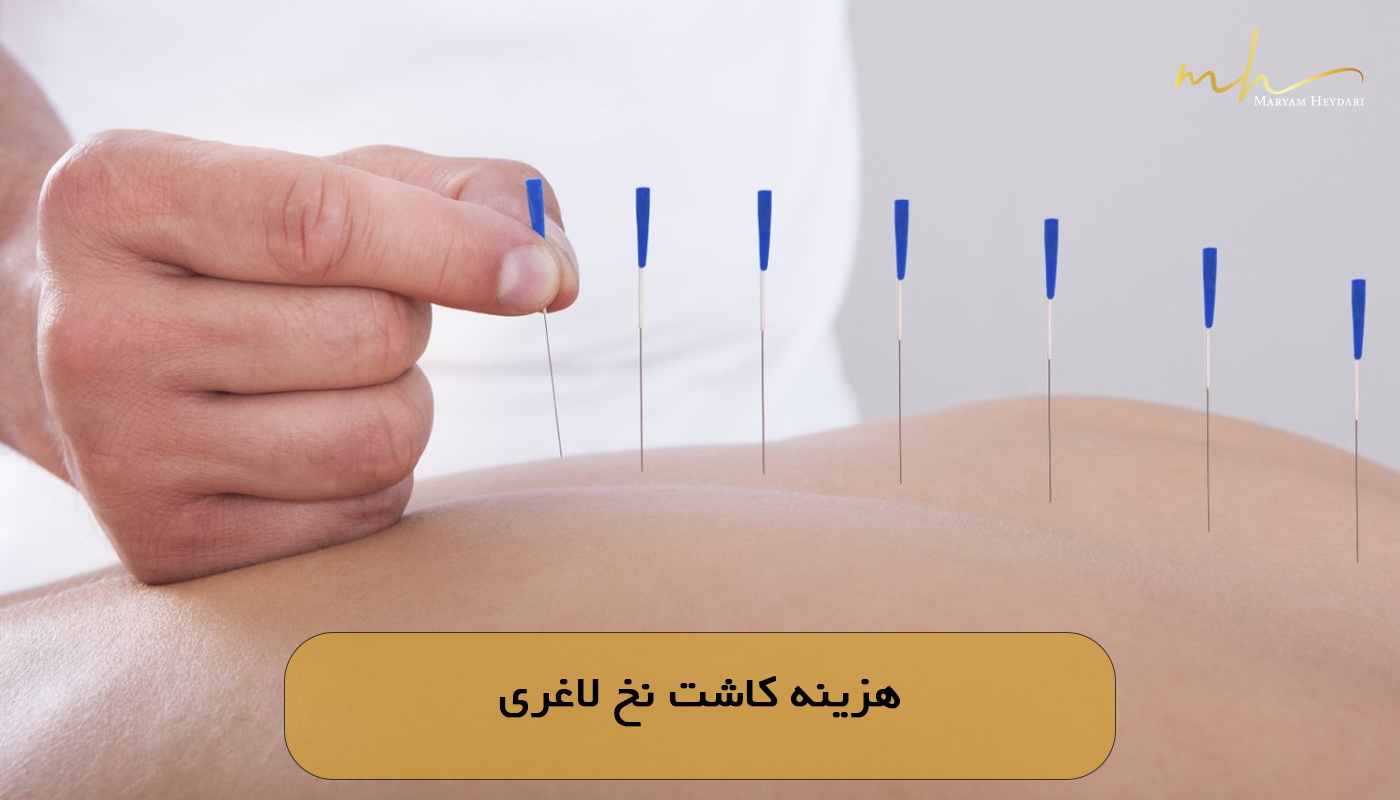 هزینه کاشت نخ لاغری