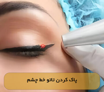 پاک کردن تاتو خط چشم