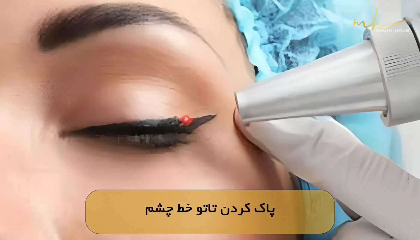 پاک کردن تاتو خط چشم