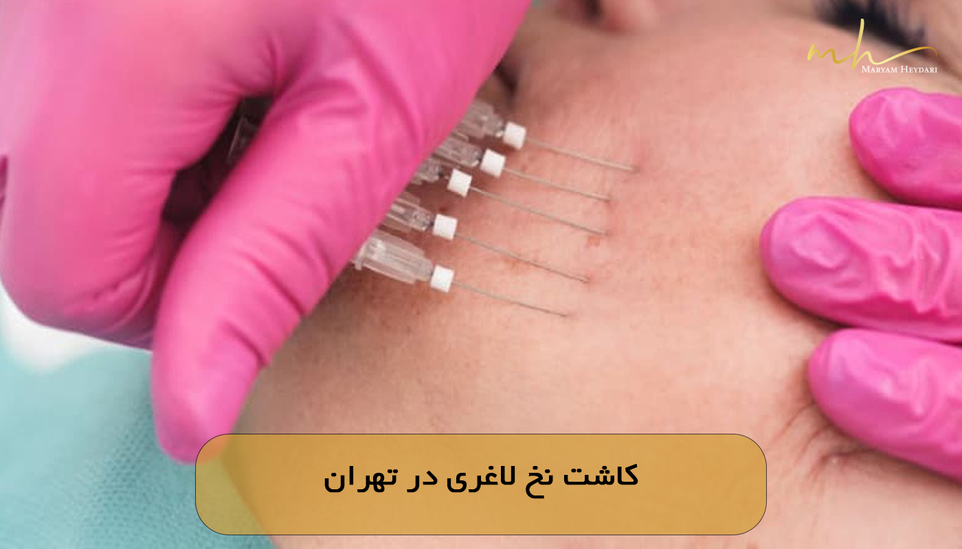 کاشت نخ لاغری در تهران