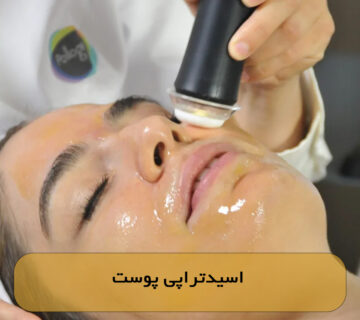 اسیدتراپی پوست