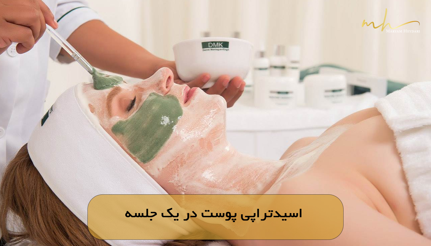 اسیدتراپی پوست در یک جلسه