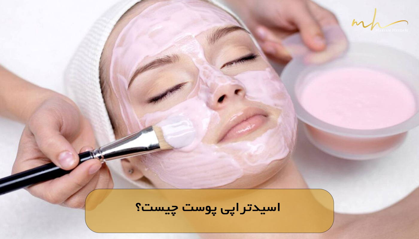 اسیدتراپی پوست چیست؟