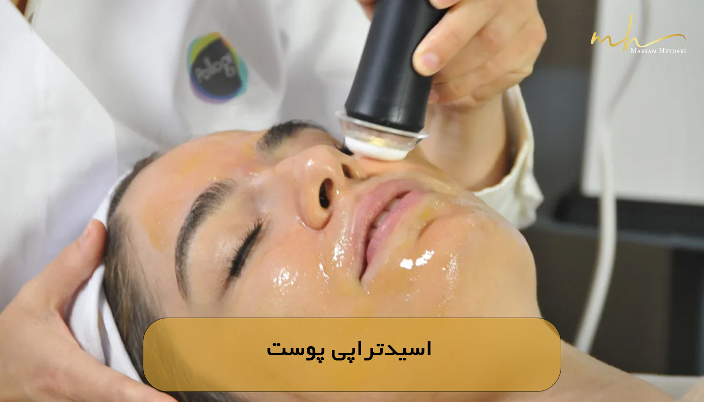 اسیدتراپی پوست