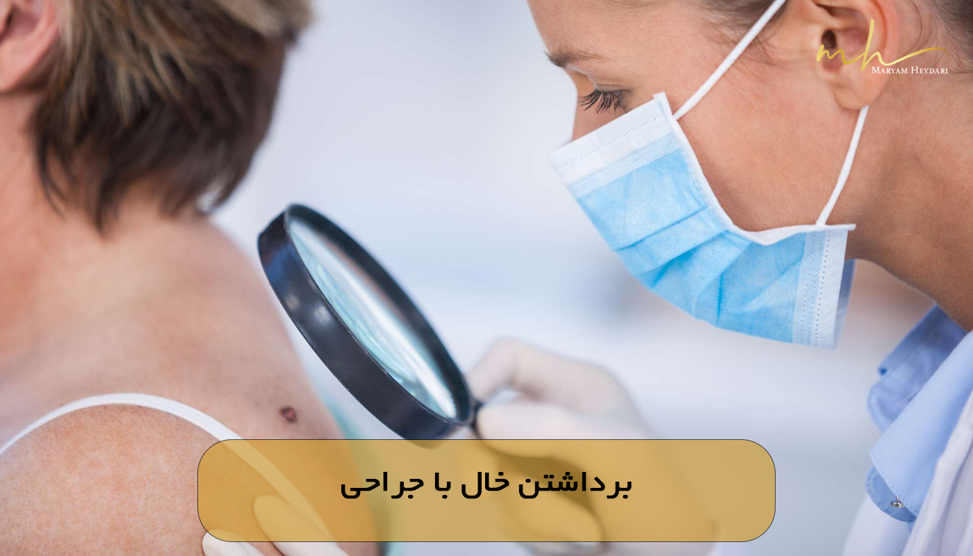 برداشتن خال با جراحی