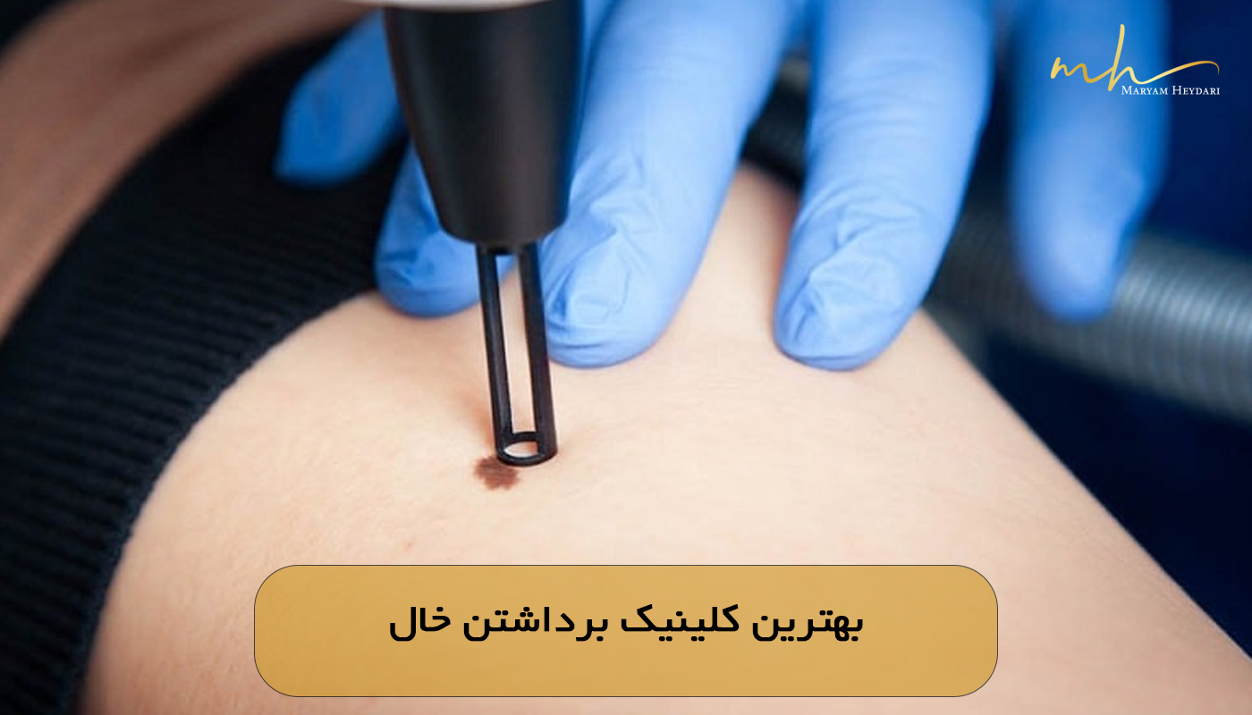 بهترین کلینیک برداشتن خال