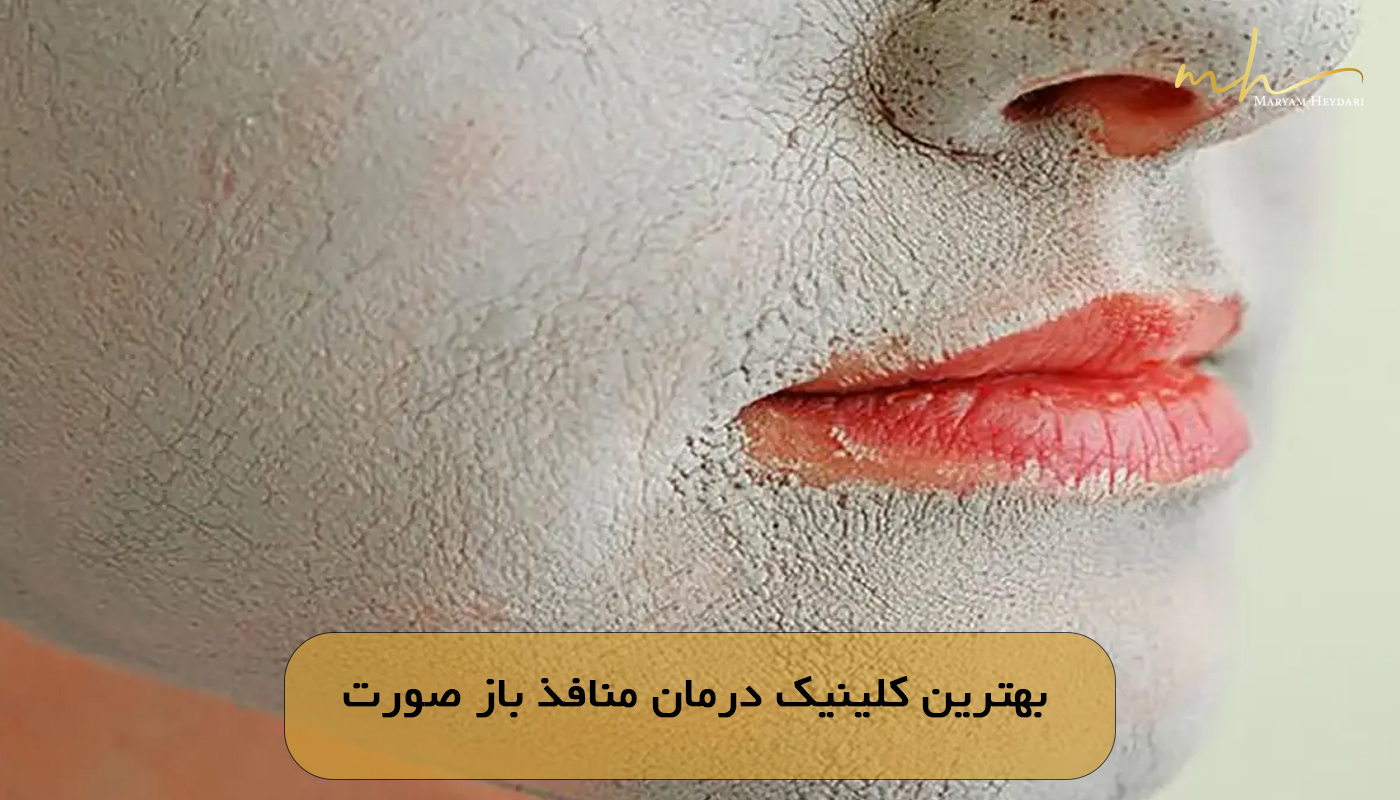 بهترین کلینیک درمان منافذ باز صورت