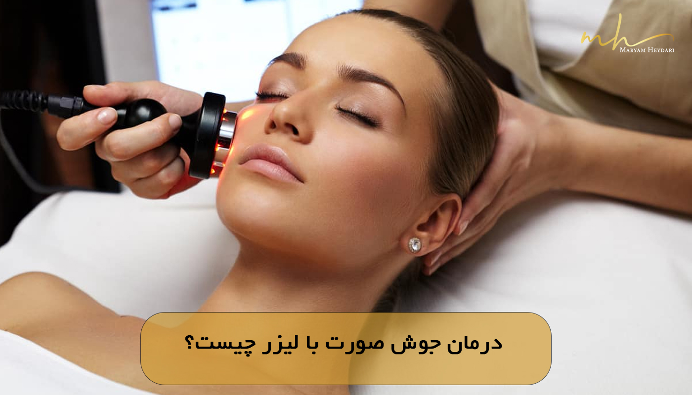 درمان جوش صورت با لیزر چیست؟