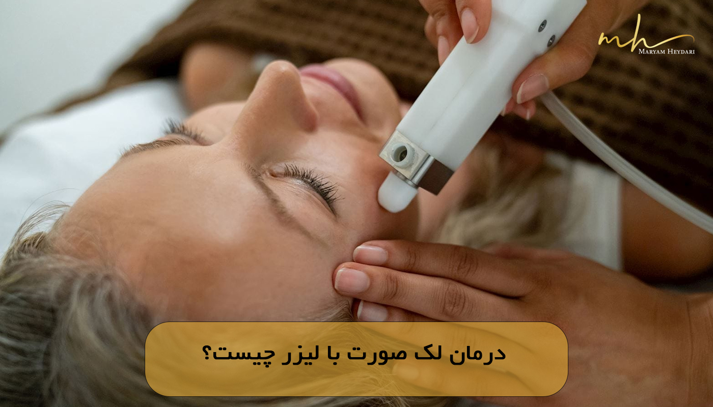 درمان لک صورت با لیزر چیست؟