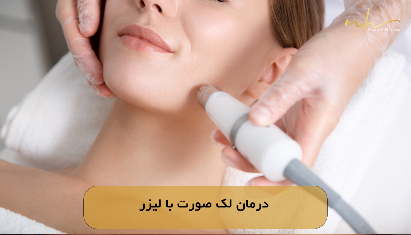 درمان لک صورت با لیزر