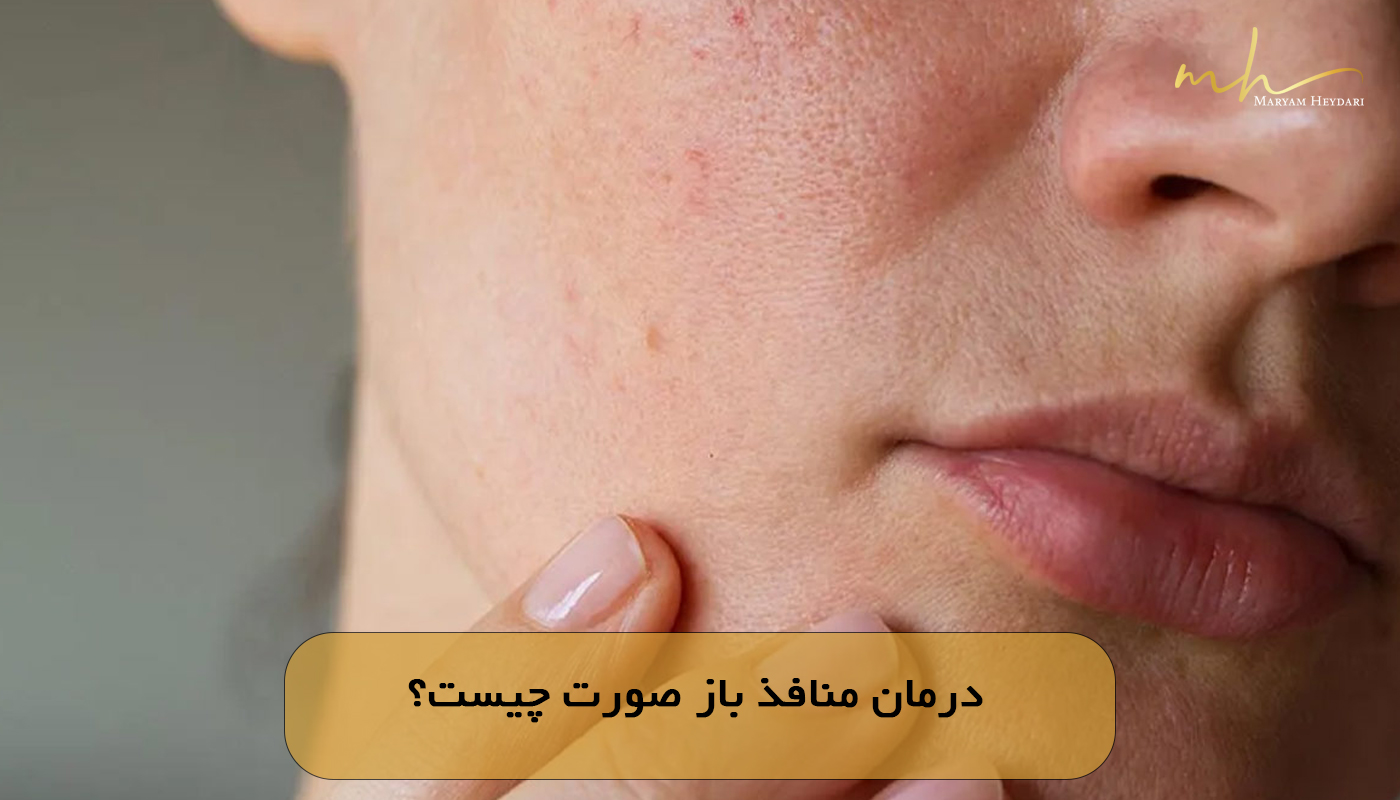 درمان منافذ باز صورت