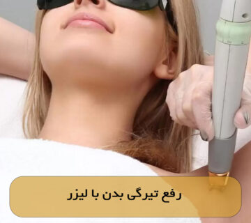 رفع تیرگی بدن با لیزر