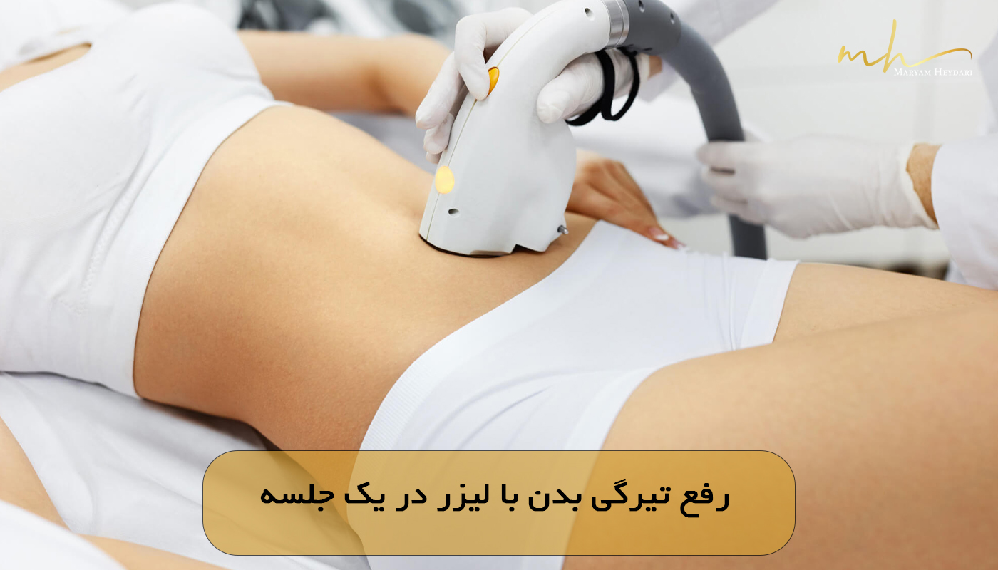 رفع تیرگی بدن با لیزر در یک جلسه