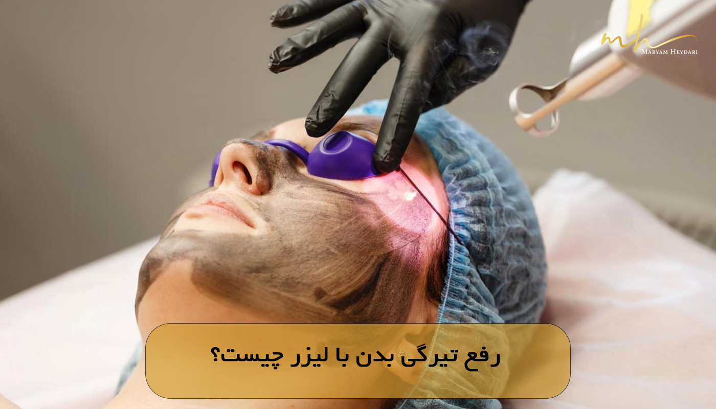 رفع تیرگی بدن با لیزر چیست؟