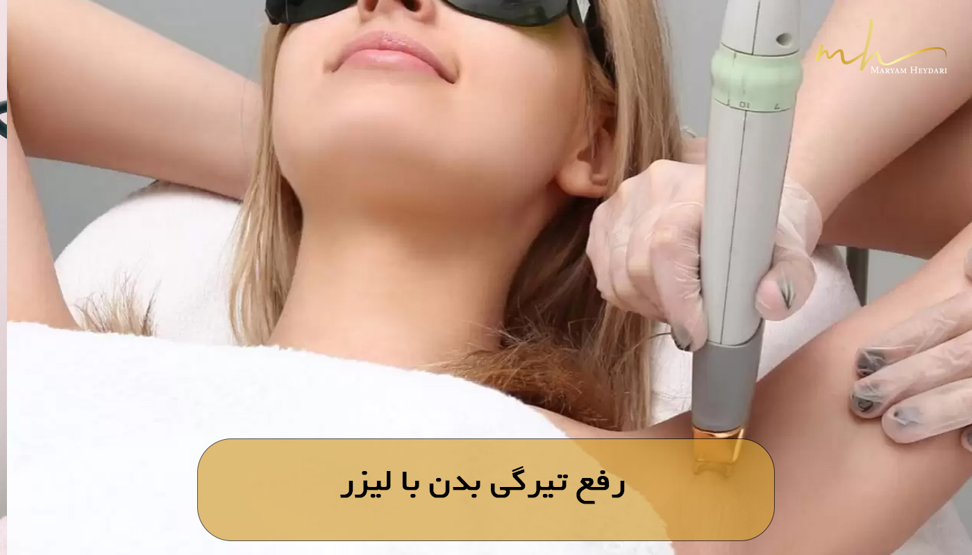 رفع تیرگی بدن با لیزر