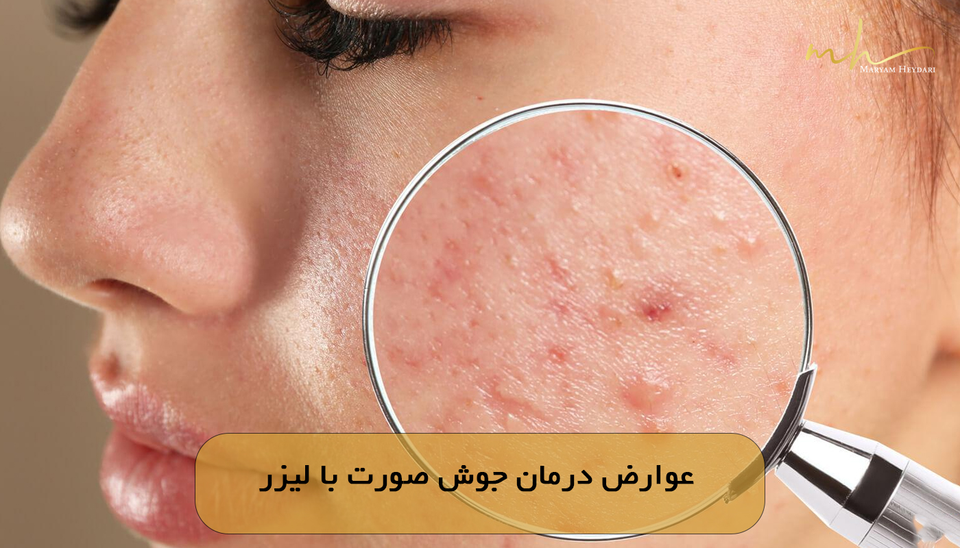 عوارض درمان جوش صورت با لیزر