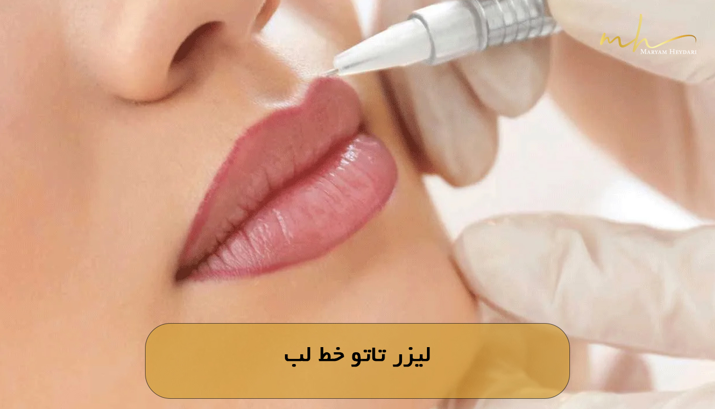 لیزر تاتو خط لب