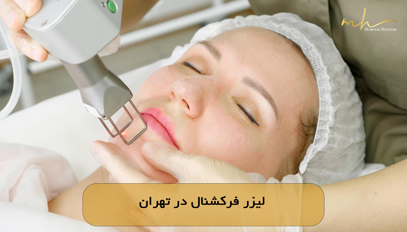 لیزر فرکشنال در تهران