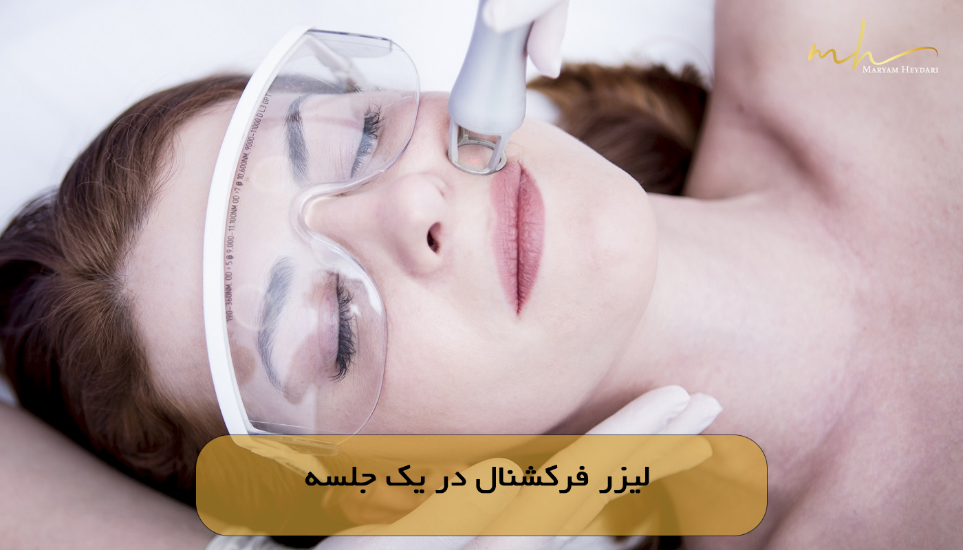 لیزر فرکشنال در یک جلسه