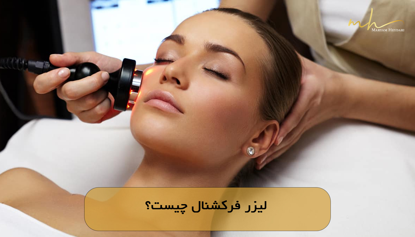 لیزر فرکشنال چیست؟