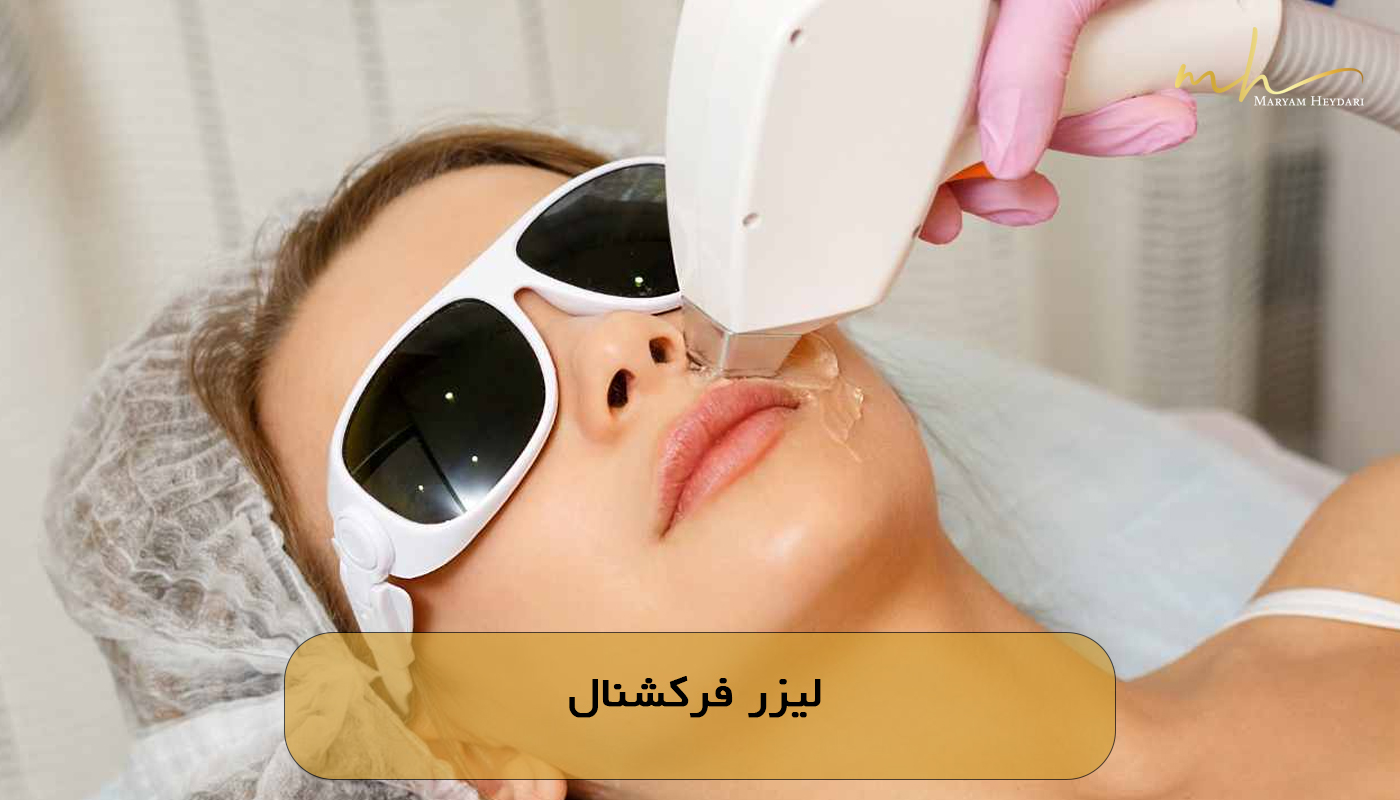 لیزر فرکشنال