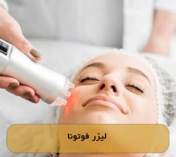 لیزر فوتونا
