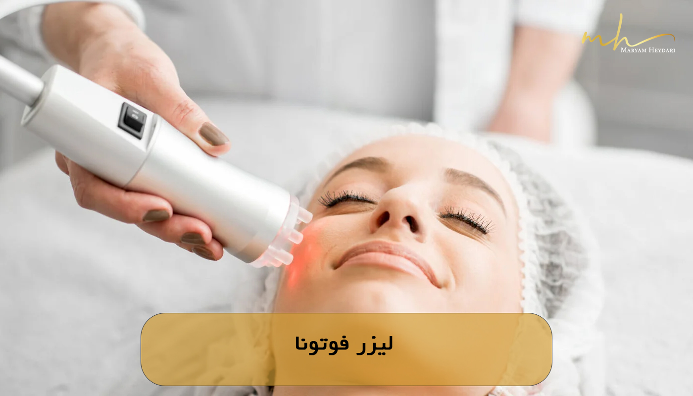 لیزر فوتونا