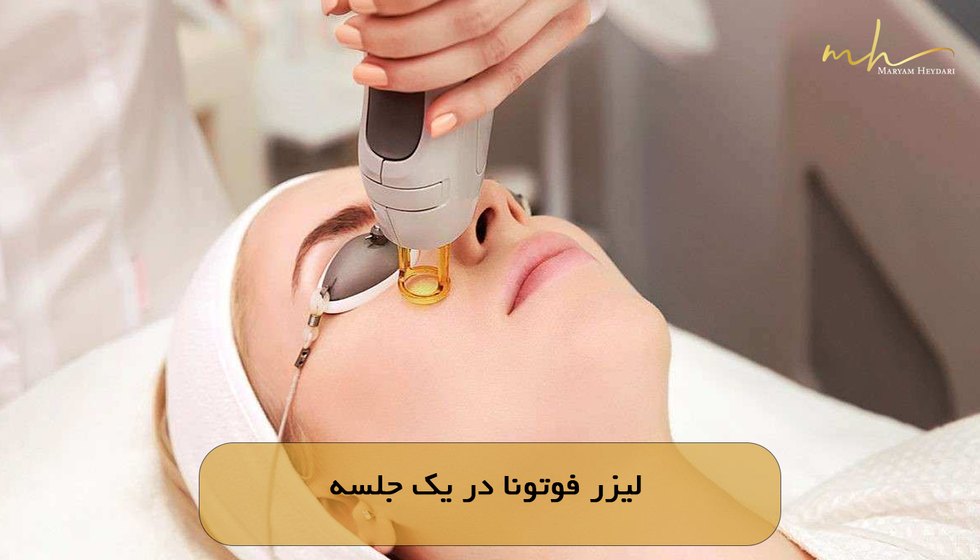 لیزر فوتونا در یک جلسه