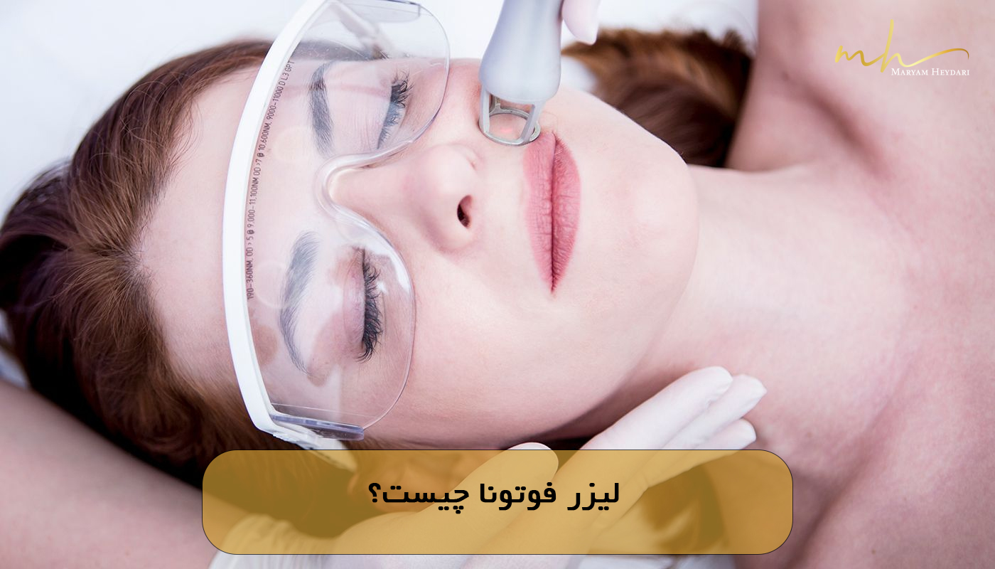 لیزر فوتونا چیست؟