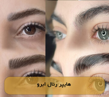هایپر رئال ابرو