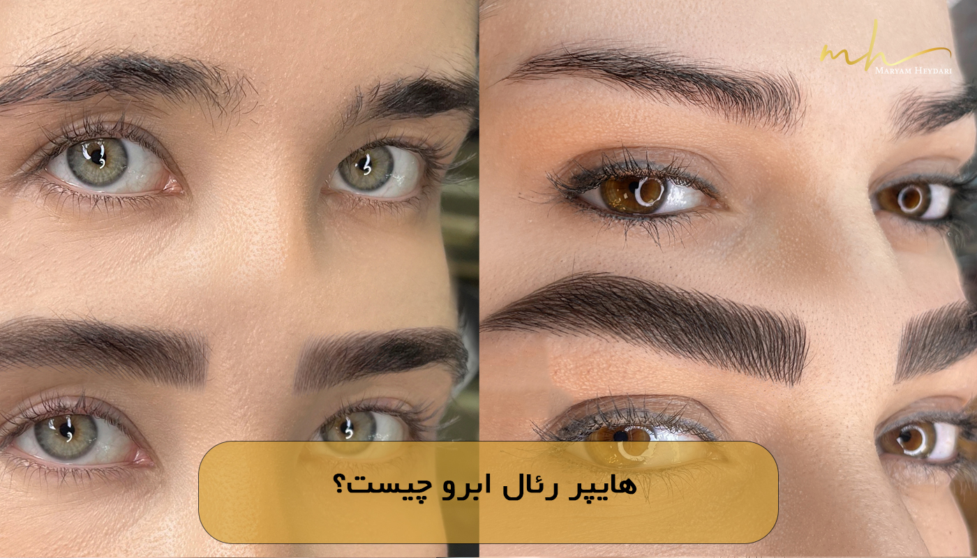 هایپر رئال ابرو چیست؟