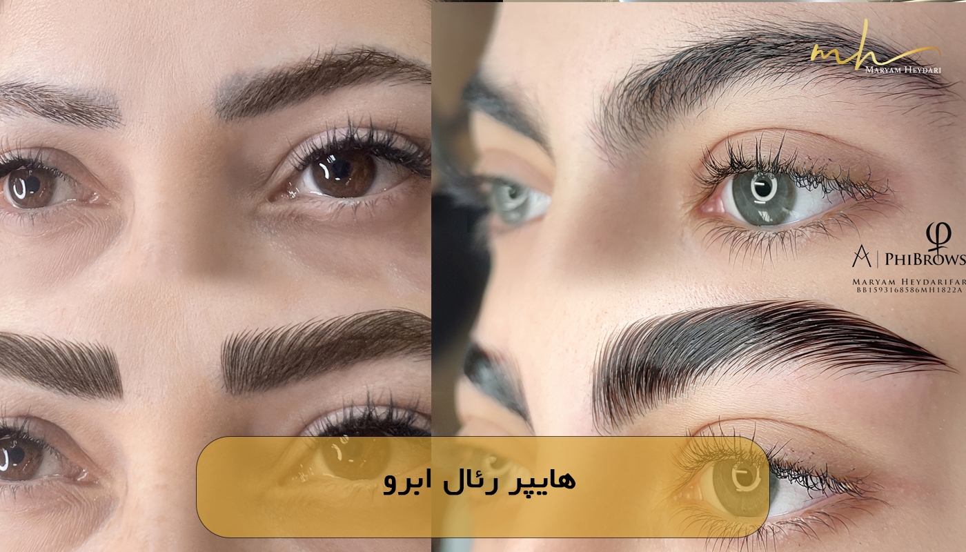 هایپر رئال ابرو