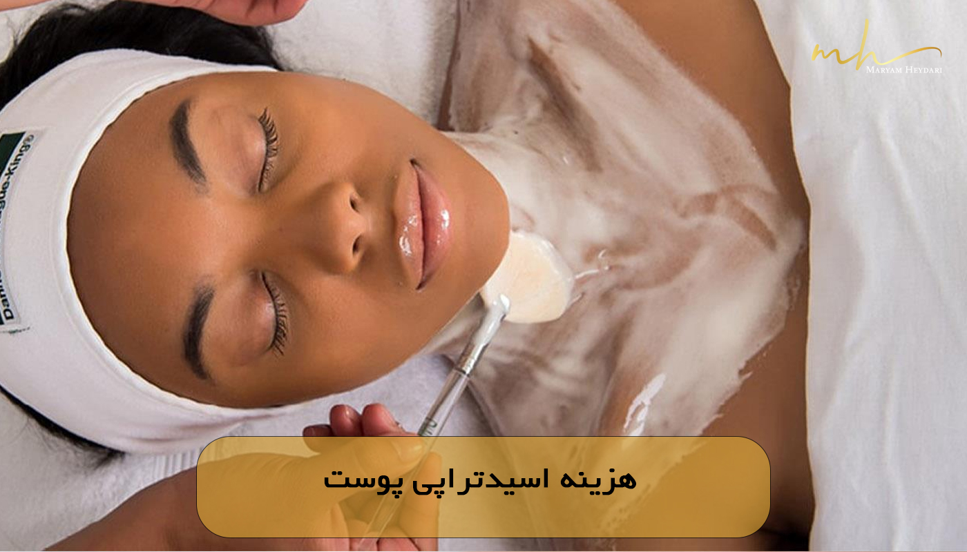 هزینه اسیدتراپی پوست