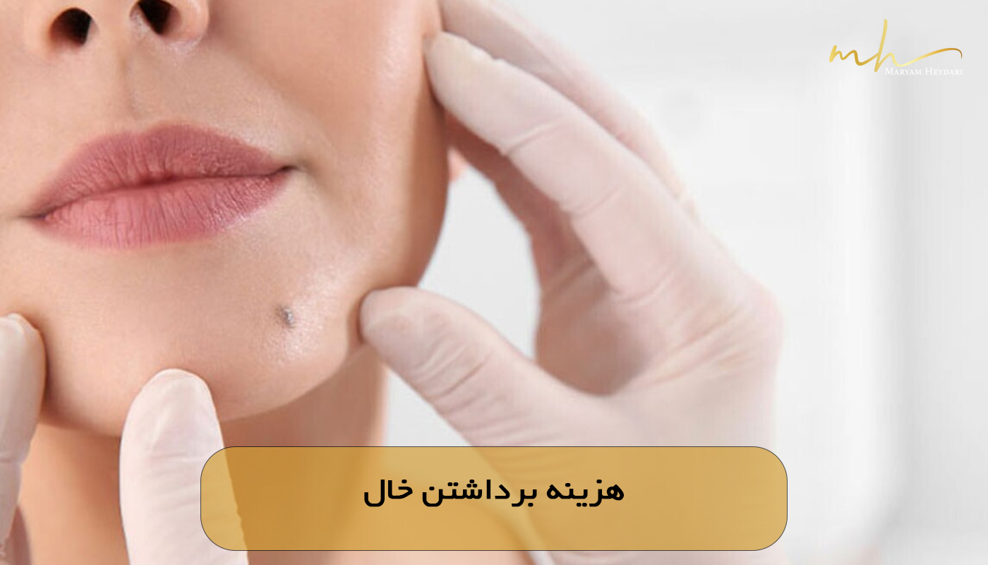 هزینه برداشتن خال